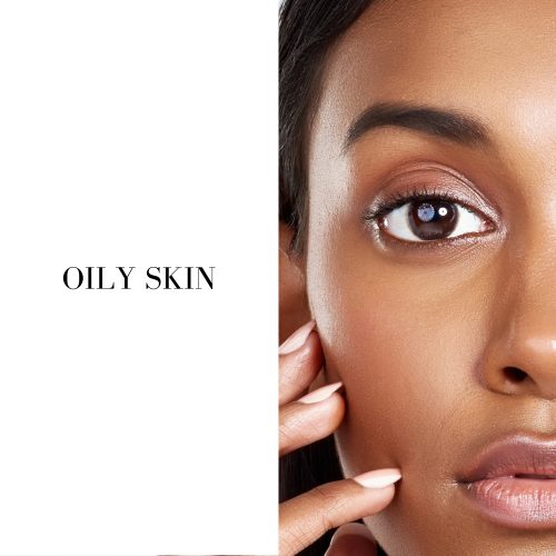 OILY SKIN